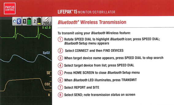 EKG Transmisión inalámbrica Bluetooth